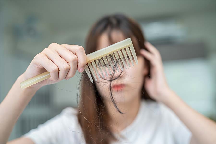 Mulher segurando um pente cheio de cabelo na frente do seu rosto. Ela está triste com isso. Representação de como a alopecia pode influenciar na saúde mental.