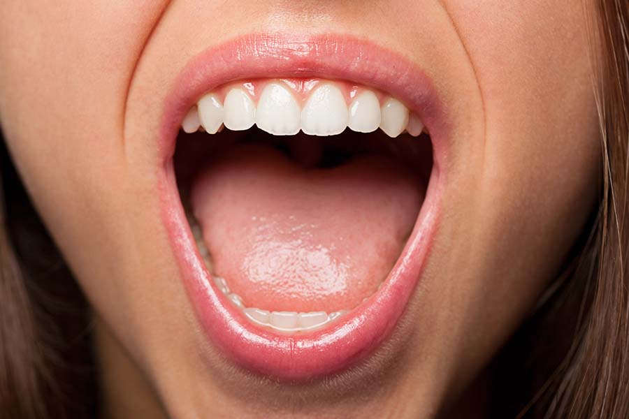 Close da boca bem aberta de uma mulher indicando que ela está gritando. Representação de como manter a saúde da voz.